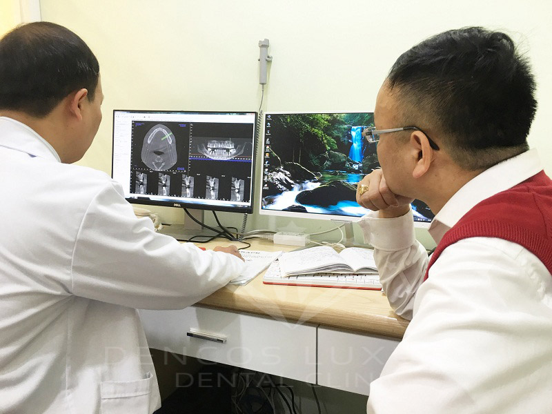 Lưu ý khi cấy ghép Implant